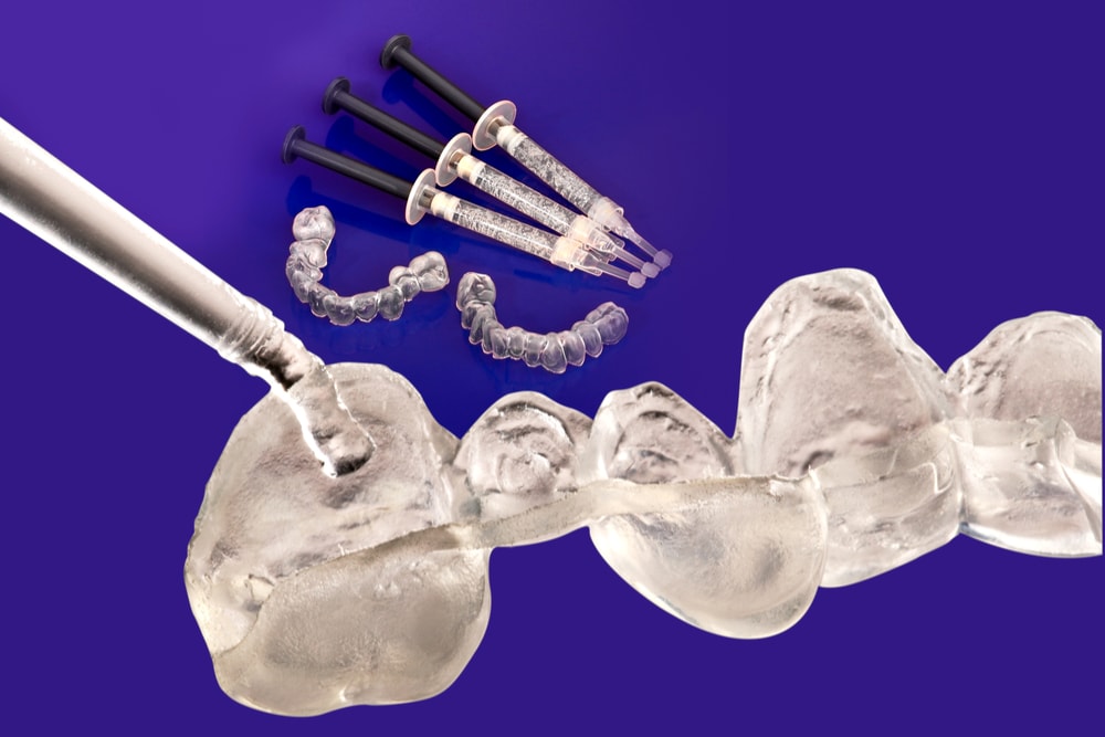 Teeth whitening trays gel home use Sutton Place Dental Associates