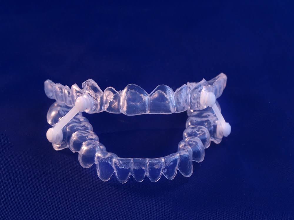 Image of an over-the-counter dental appliance