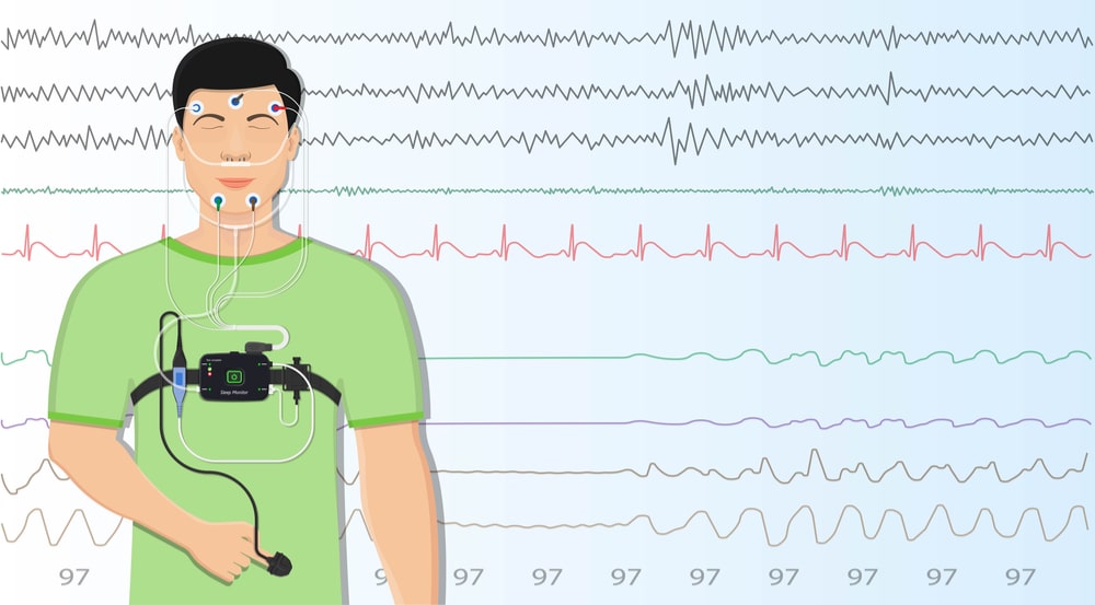 Image of a man sleeping while connected to many probes, cables and recording devices which plot the data.