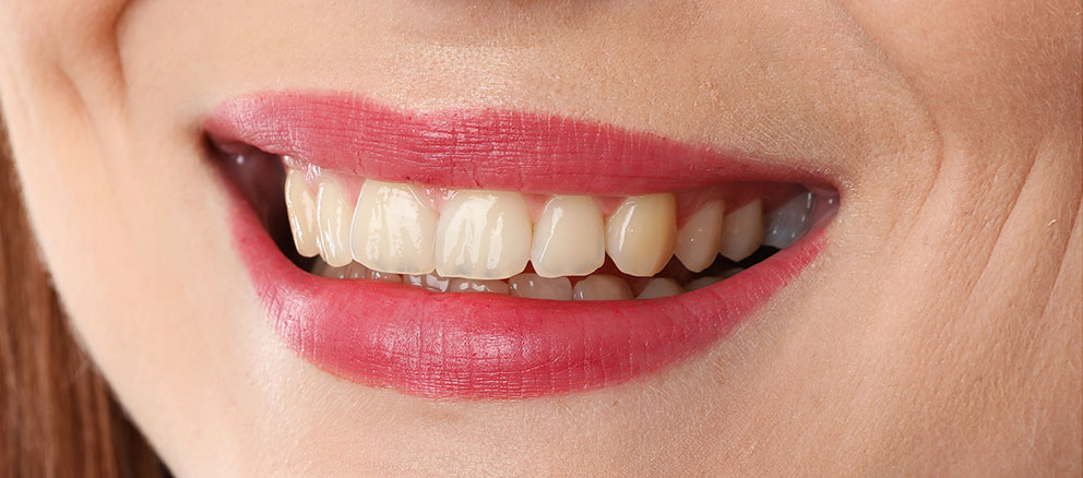 zoom teeth whitening near me zoom teeth whitening near me