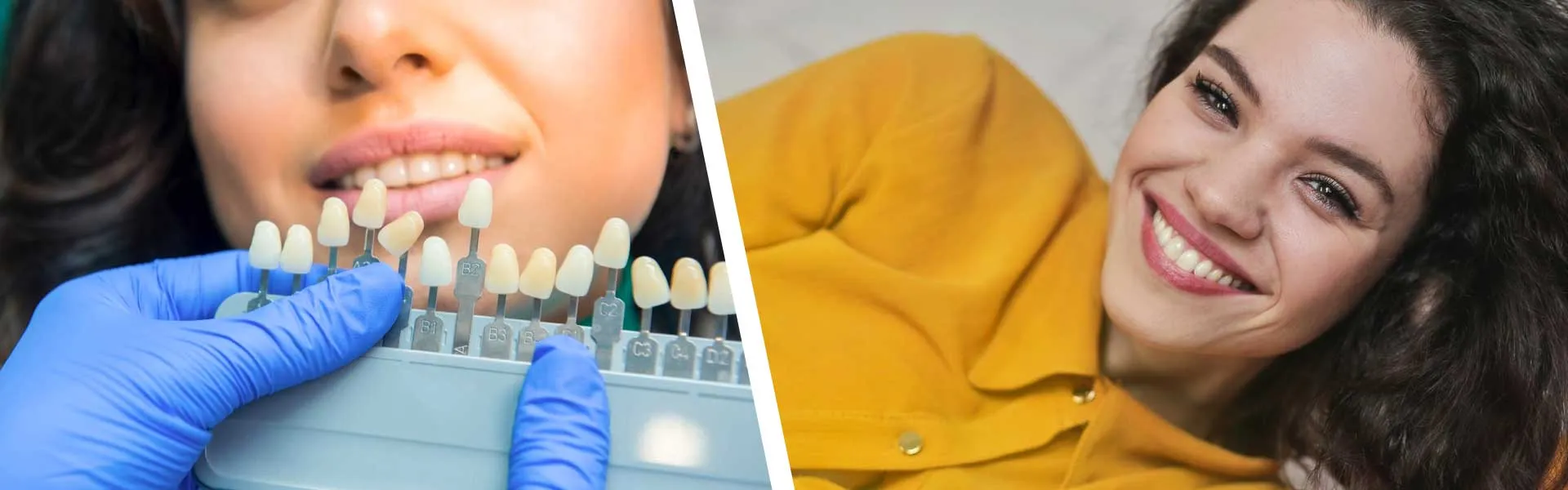 ZOOM TEETH WHITENING